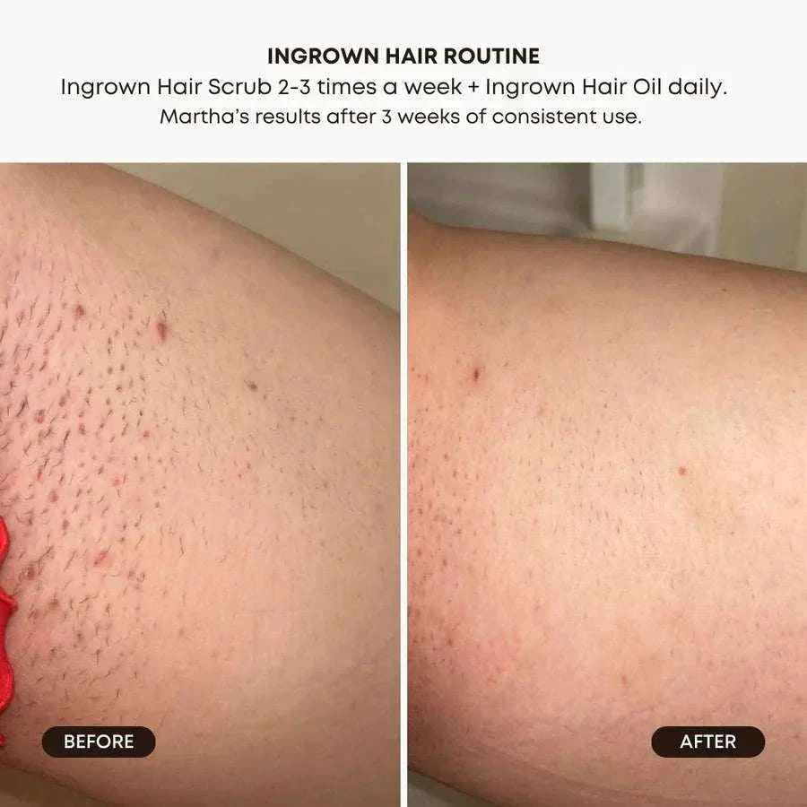 Post Care: Skin Relief, Bushbalm & Finipil | Sugarmoon®
