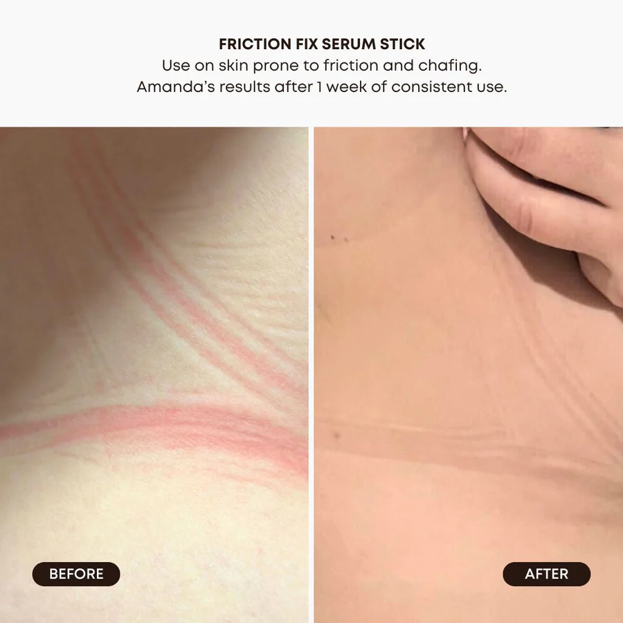 Before and after comparison showing reduced skin redness and irritation after one week of using Friction Fix Serum Stick for friction and chafing relief